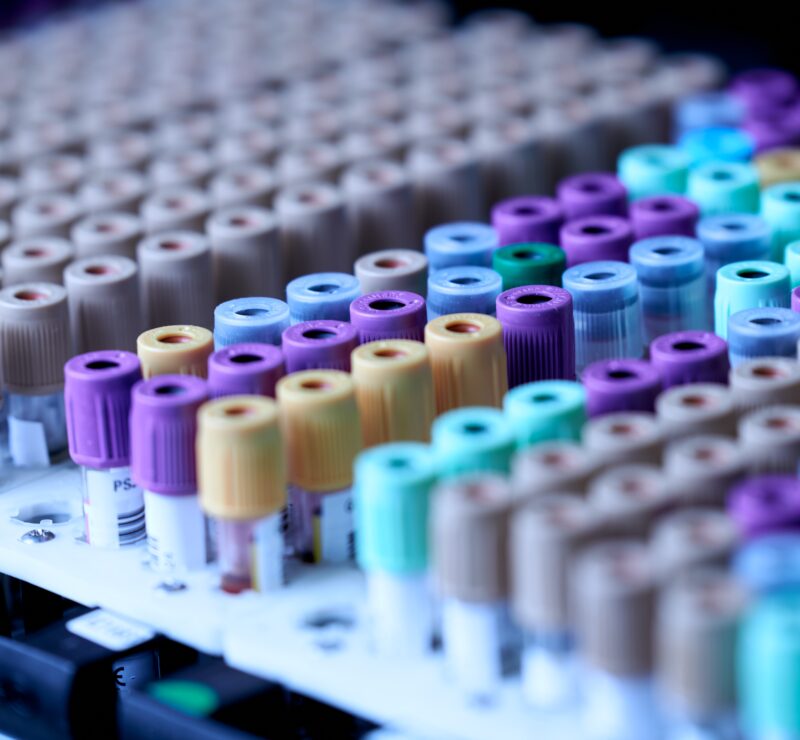 Shelf Life Testing in the UAE